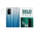Гидрогелевая пленка SKLO для камеры для Oppo A73 (2017) – Прозрачный. Фото 1 Гидрогелевая пленка SKLO для камеры для Oppo A73 (2017) – Прозрачный. Фото 1 из 1
