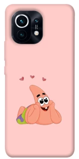 Чохол на Xiaomi Mi 11 Патрік Стар фото 1 з 1