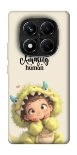 Чохол на Xiaomi Redmi Note 14 Pro 4G You are amazing фото 1 з 1