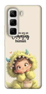 Чохол на Infinix Hot 50 4G You are amazing фото 1 з 1