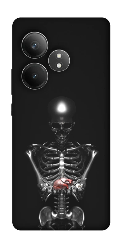Чохол на Realme GT Neo 6 SE Скелетон фото 1 з 1