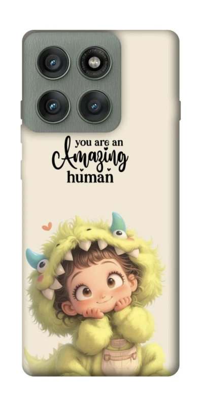 Чохол на Motorola Edge 60 Pro You are amazing фото 1 з 1