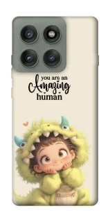 Чохол на Motorola Edge 60 Pro You are amazing фото 1 з 1