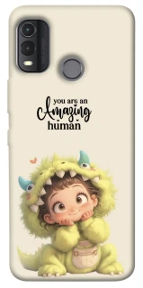 Чехол на Nokia G11 Plus You are amazing фото 1 из 1