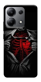Чохол на Xiaomi Redmi Note 13 4G Skeleton Heart фото 1 з 1