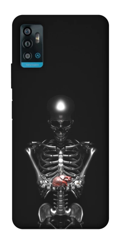Чохол на ZTE Blade A71 Скелетон фото 1 з 1