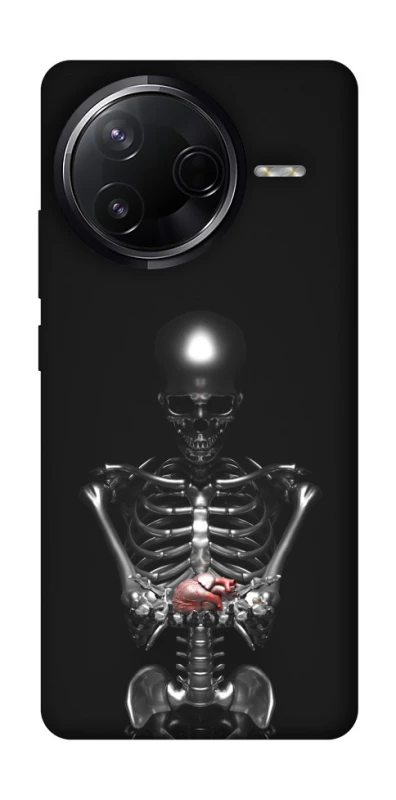 Чохол на Infinix Note 50 Pro Скелетон фото 1 з 1