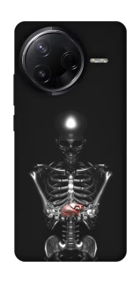 Чохол на Infinix Note 50 Pro Скелетон фото 1 з 1