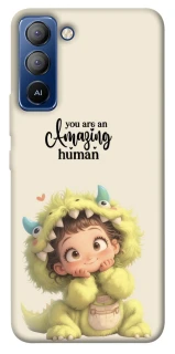Чехол на TECNO Pop 5 LTE You are amazing фото 1 из 1