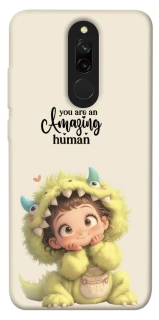 Чехол на Xiaomi Redmi 8 You are amazing фото 1 из 1