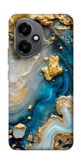 Чохол на Honor 400 Epoxy design ver.2 фото 1 з 1