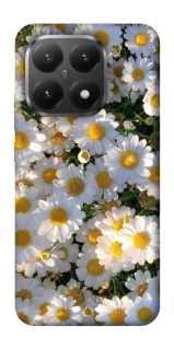 Чехол на Xiaomi 15T Поле ромашек фото 1 из 1
