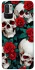 Чохол на Xiaomi Poco M3 Pro 4G / 5G skull and rose фото 1 з 1