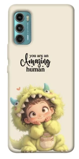 Чохол на Motorola Moto G60 You are amazing фото 1 з 1