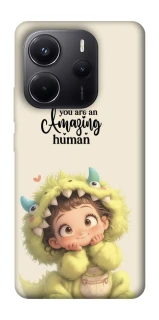 Чохол на Xiaomi Redmi Note 14 4G (Europe version) You are amazing фото 1 з 1