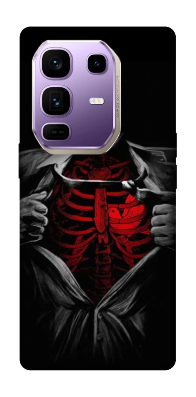 Чохол на Infinix Note 50 Pro+ Skeleton Heart фото 1 з 1