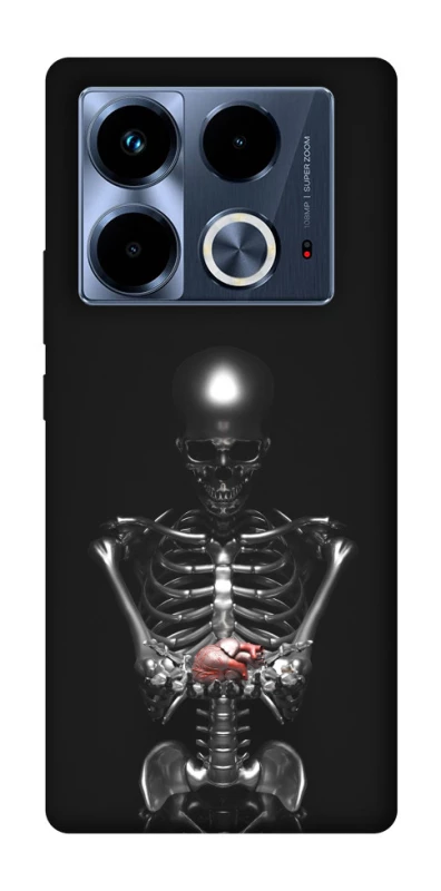 Чохол на Infinix Note 40 4G Скелетон фото 1 з 1
