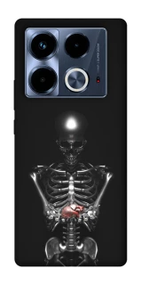 Чохол на Infinix Note 40 4G Скелетон фото 1 з 1