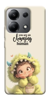 Чехол на Xiaomi Redmi Note 13 4G You are amazing фото 1 из 1