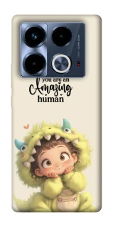 Чохол на Infinix Note 40 4G You are amazing фото 1 з 1