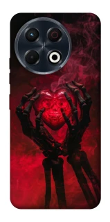 Чехол на TECNO Spark 30 Pro (KL7) Heart in the hands of a skeleton фото 1 из 1