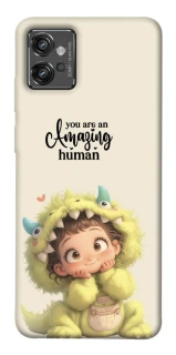 Чохол на Motorola Moto G32 You are amazing фото 1 з 1