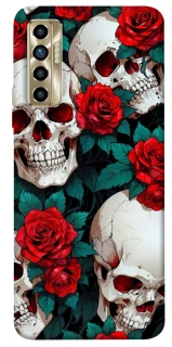 Чохол на TECNO Camon 17P skull and rose фото 1 з 1
