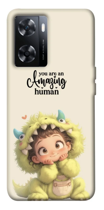 Чохол на OnePlus Nord N20 SE You are amazing фото 1 з 1