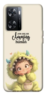 Чехол на OnePlus Nord N20 SE You are amazing фото 1 из 1