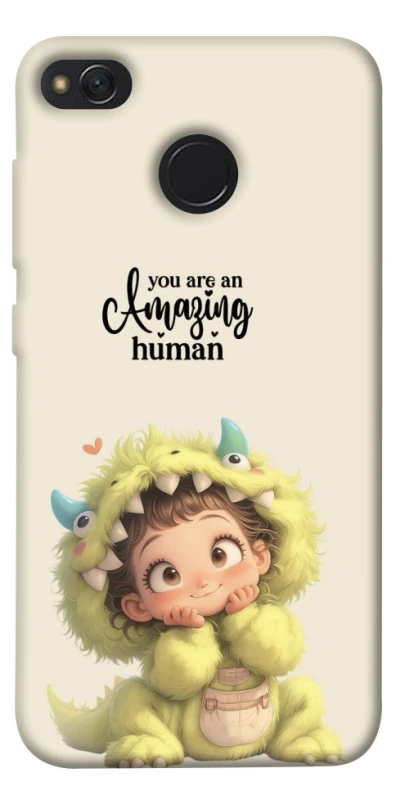 Чехол на Xiaomi Redmi 4X You are amazing фото 1 из 1