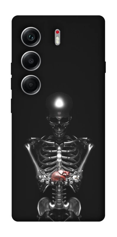Чохол на Tecno Camon 40 Скелетон фото 1 з 1