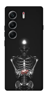 Чохол на Tecno Camon 40 Скелетон фото 1 з 1