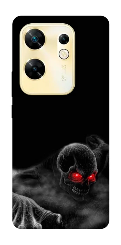 Чохол на Infinix Zero 30 4G Skeleton v3 фото 1 з 1