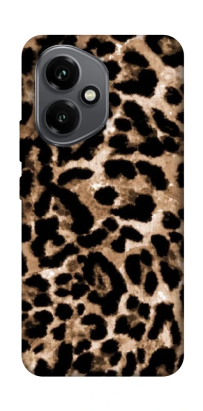 Чохол на Honor 400 Leopard Skin v4 фото 1 з 1