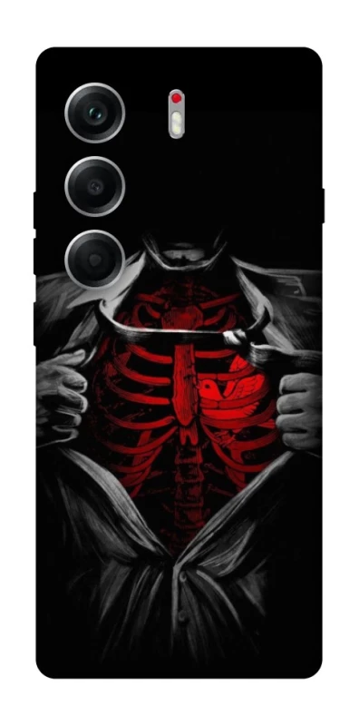 Чохол на Tecno Camon 40 Skeleton Heart фото 1 з 1