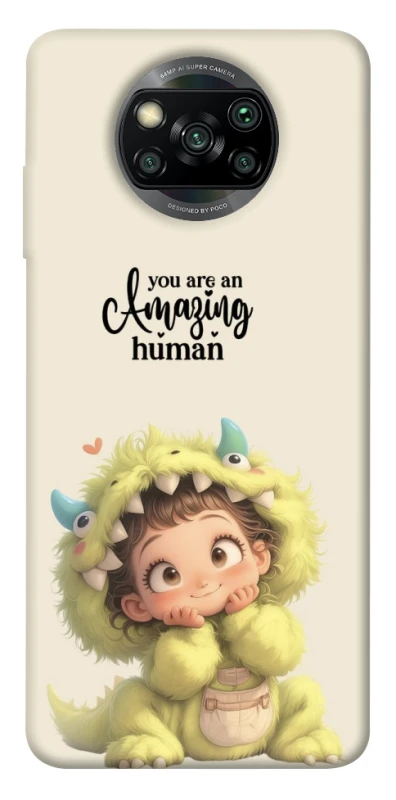 Чехол на Xiaomi Poco X3 NFC / Poco X3 Pro You are amazing фото 1 из 1