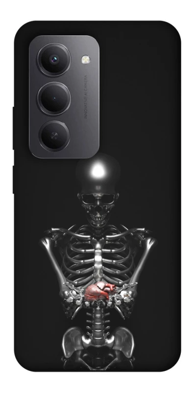 Чехол на Xiaomi Redmi 15 (EU) Скелетон фото 1 из 1