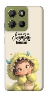 Чохол на Motorola Moto G15 4G You are amazing фото 1 з 1