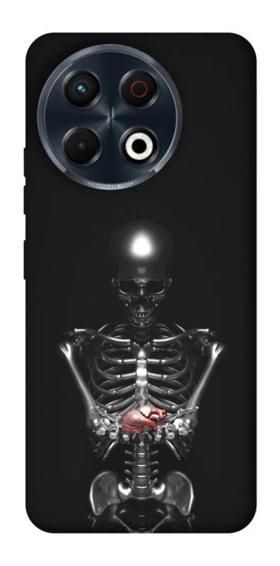 Чохол на TECNO Spark 30 Pro (KL7) Скелетон фото 1 з 1