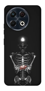 Чохол на TECNO Spark 30 Pro (KL7) Скелетон фото 1 з 1