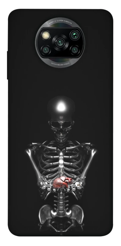 Чехол на Xiaomi Poco X3 NFC / Poco X3 Pro Скелетон фото 1 из 1