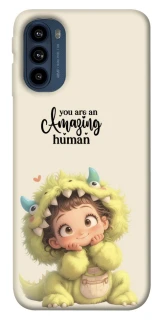 Чехол на Motorola Moto G41 You are amazing фото 1 из 1