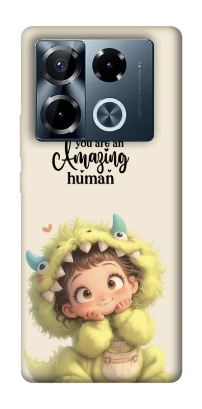 Чохол на Infinix Note 40 Pro 4G You are amazing фото 1 з 1