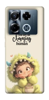 Чохол на Infinix Note 40 Pro 4G You are amazing фото 1 з 1