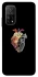 Чохол на Xiaomi Mi 10T Heart with flowers фото 1 з 1
