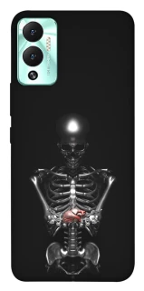 Чохол на Infinix Hot 12 Play Скелетон фото 1 з 1