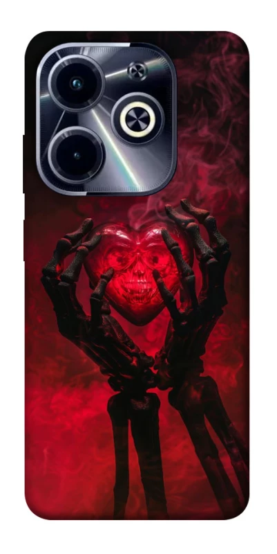 Чохол на Infinix Hot 40i Heart in the hands of a skeleton фото 1 з 1