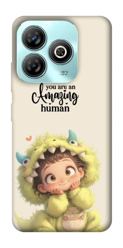 Чохол на ZTE Blade A75 4G You are amazing фото 1 з 1