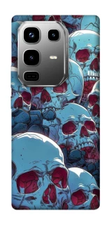 Чехол на Infinix Note 50 Pro Skulls v2 фото 1 из 1