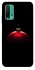 Чохол на Xiaomi Redmi Note 9 4G / Redmi 9 Power Christmas bauble фото 1 з 1